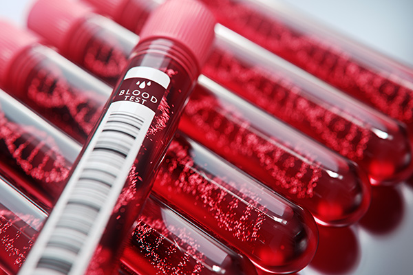 Cell-free Fetal DNA Testing