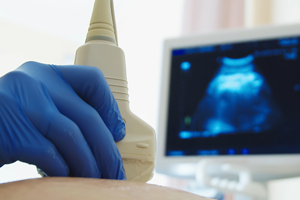 First Trimester Screening