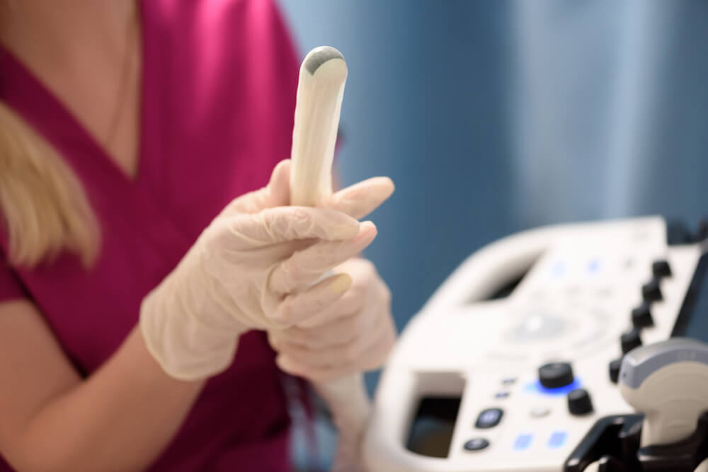 Everything You Need To Know About Gynecological Ultrasound Exams