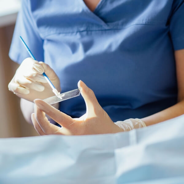 Pap Smear