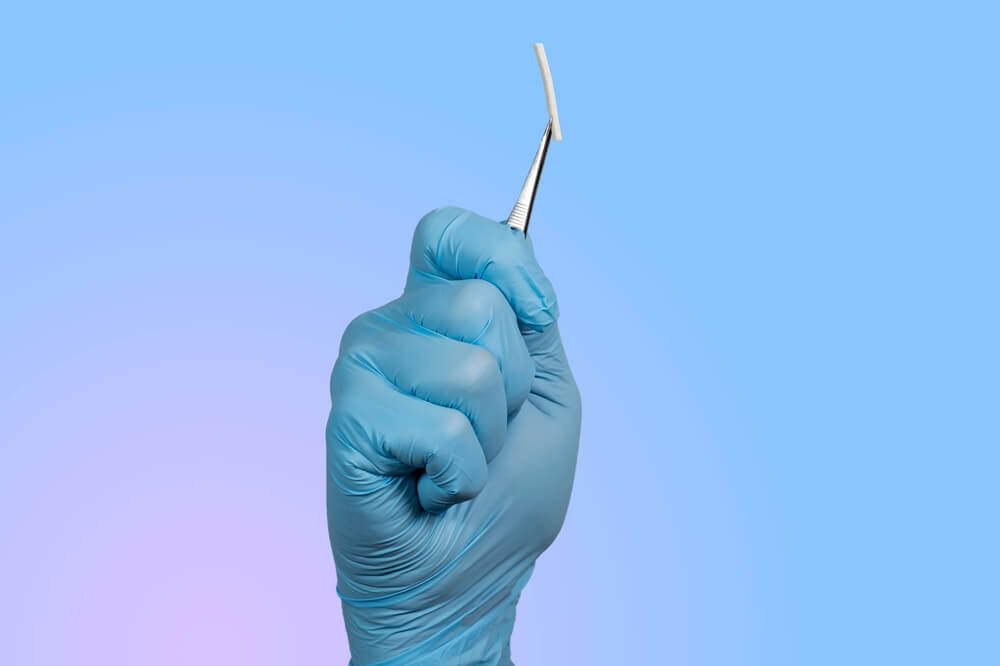 Hormonal Implant or Beauty Chip Is a Subcutaneous Application.