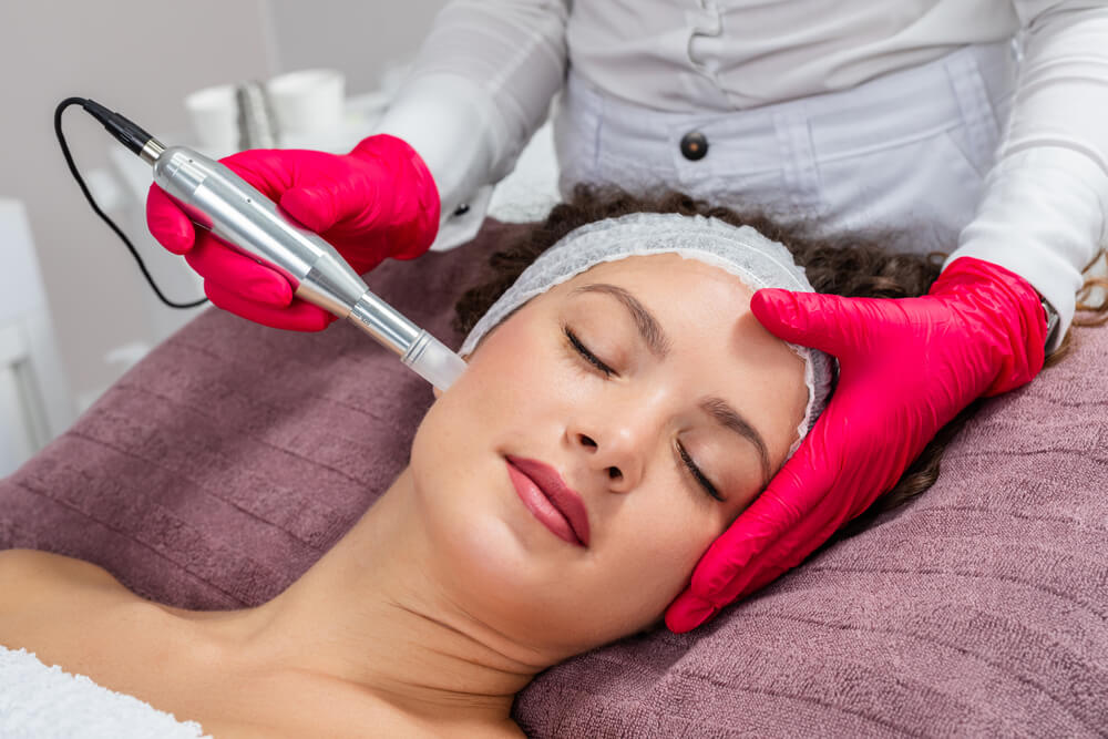 Beautiful Woman Receiving Microneedling Rejuvenation Treatment