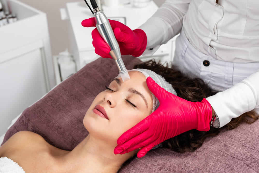 Beautiful Woman Receiving Microneedling Rejuvenation Treatment