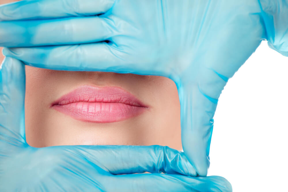 Doctor Hand in Gloves Shaping a Frame Around Lips, Mouth of a Girl