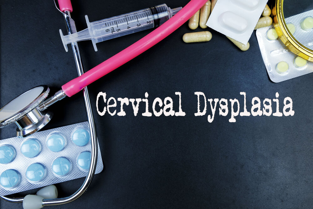 Cervical Dysplasia Word Medical Term Word With Medical Concepts In Blackboard And Medical Equipment