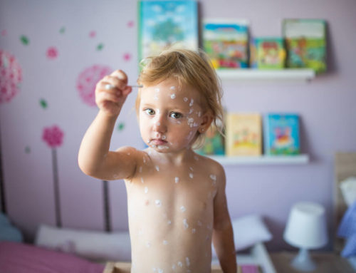 8 Common Skin Rashes in Children