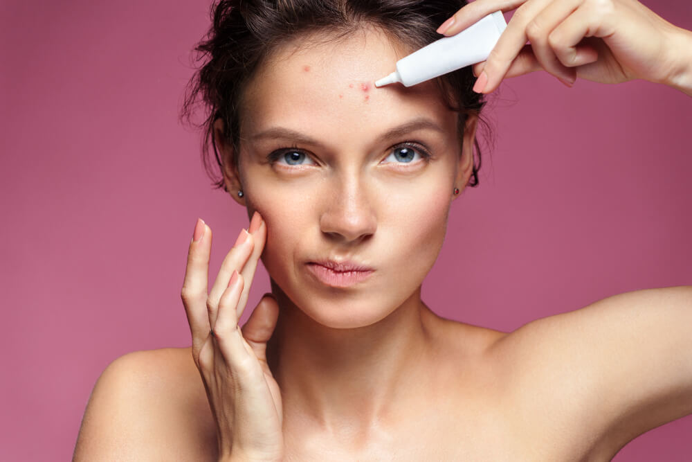 Scowling Girl Pointing at Her Acne and Applying Treatment Cream