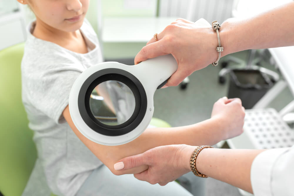 A Dermatologist Examines a Teenagers Skin Condition With a Dermatoscope.