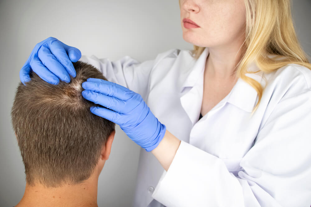 A Trichologist Examines the Hair of a Man Who Begins Alopecia.
