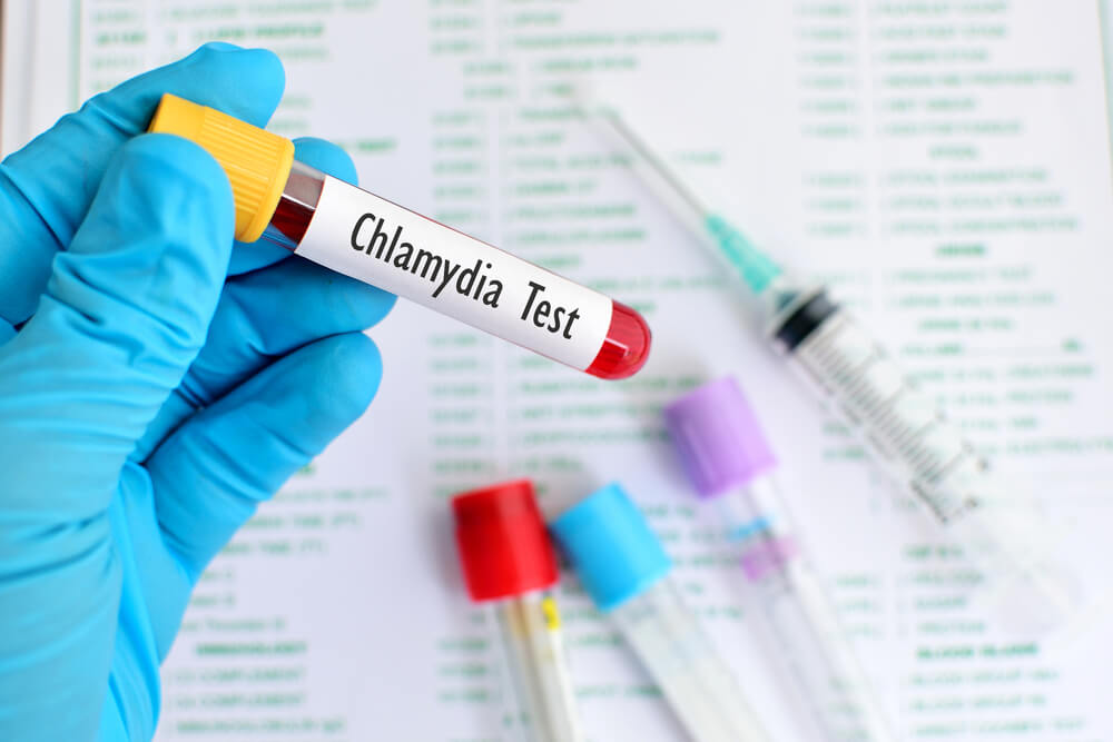 Blood Sample for Chlamydia Test