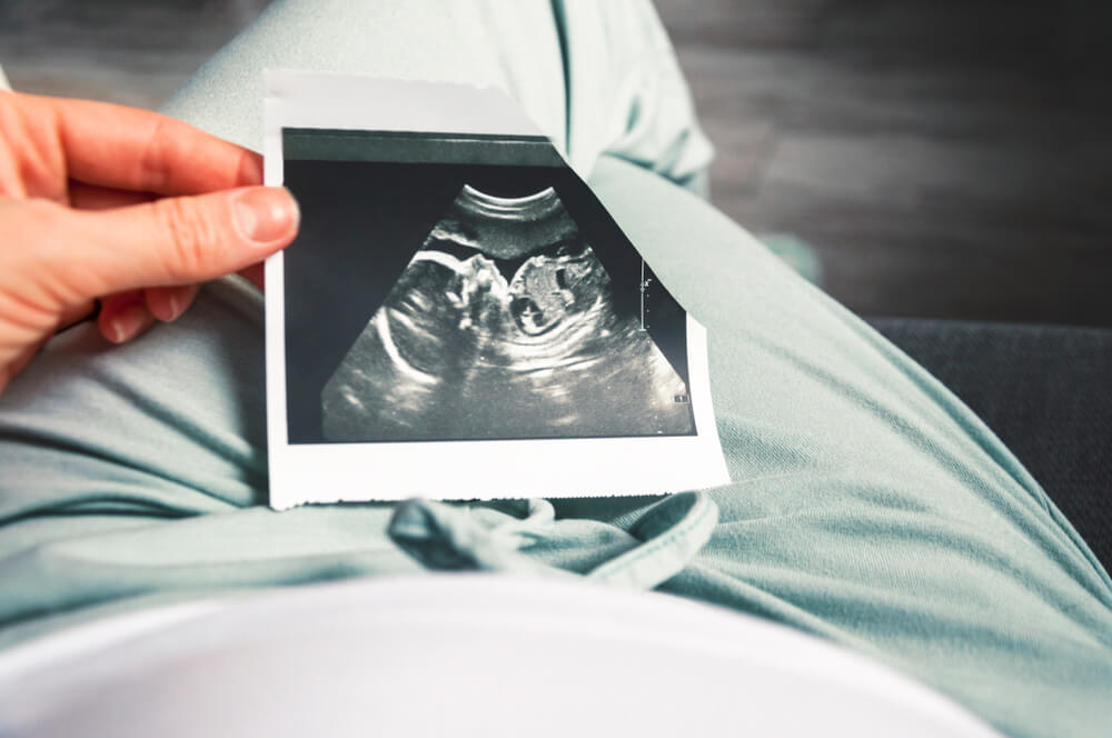 A Girl Holds a Picture of an Ultrasound Baby in Her Twentieth Week of Pregnancy