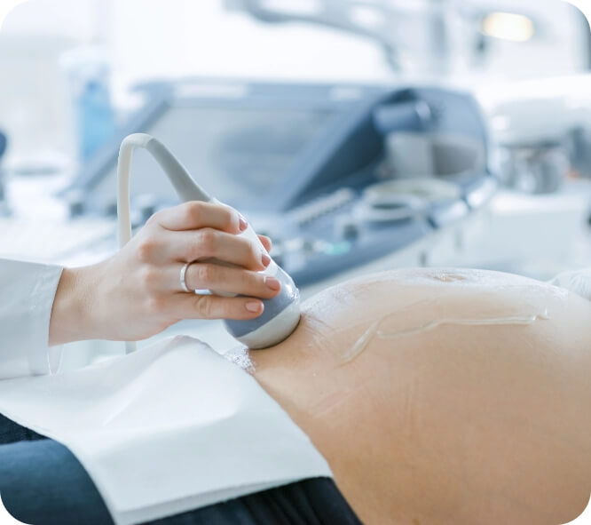 sonography