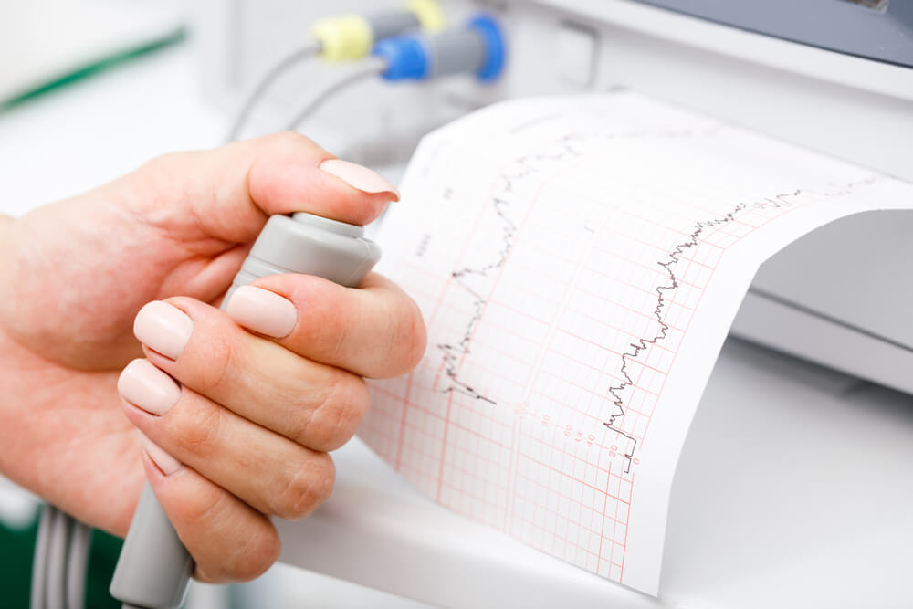 Cardiotocograph Machine AKA Electronic Fetal Monitor (Efm) Recording the Fetal Heartbeat and the Uterine Contractions During Pregnancy