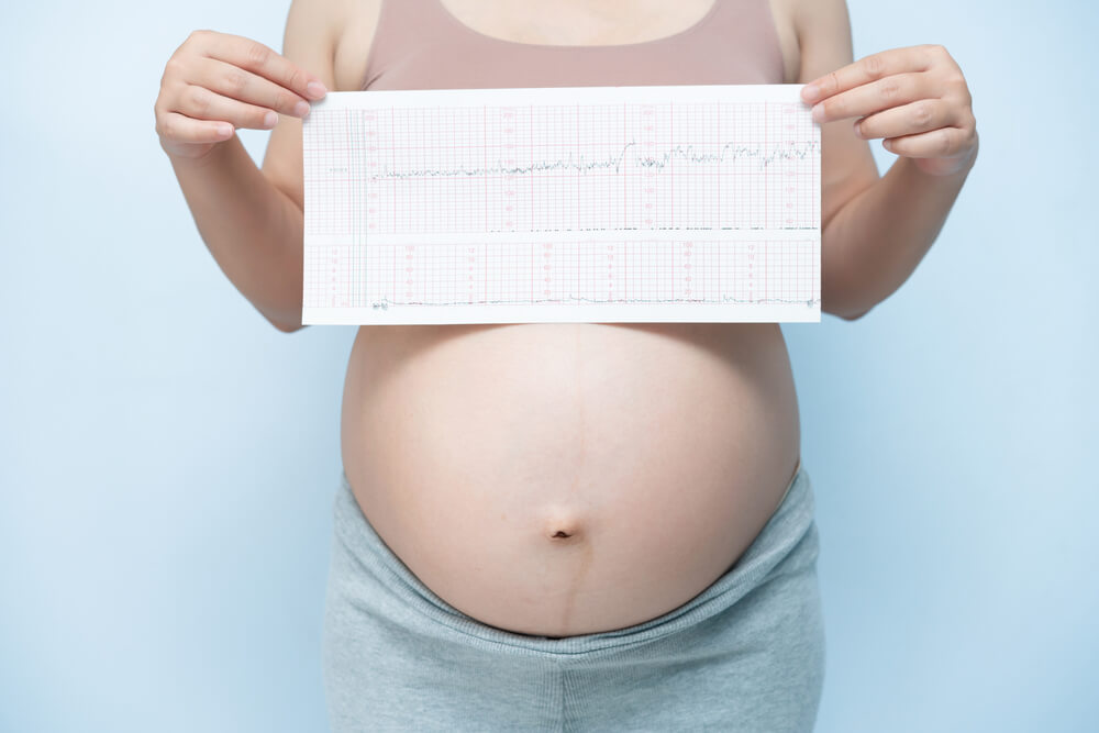 Close Up Pregnant Woman Holding Ctg Graph in Hand on Blue Background. Waiting Baby Concept.