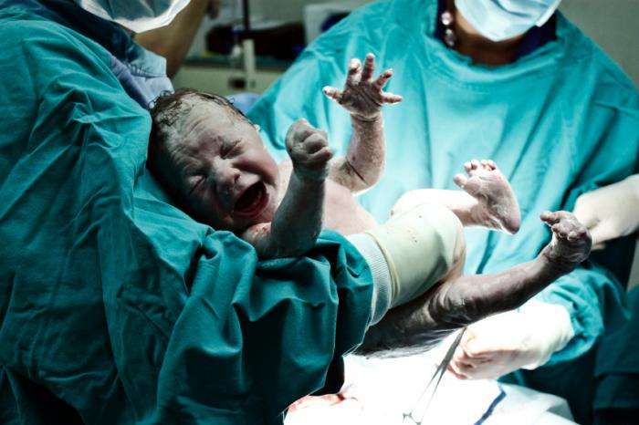 Newborn in Doctors Hands in Labor Room