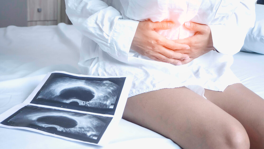 Woman Sitting Closed to Her Stomach Because of Abdominal Pain and a X-Ray Film