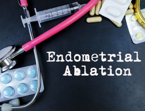 Endometrial Ablation – Everything About the Procedure
