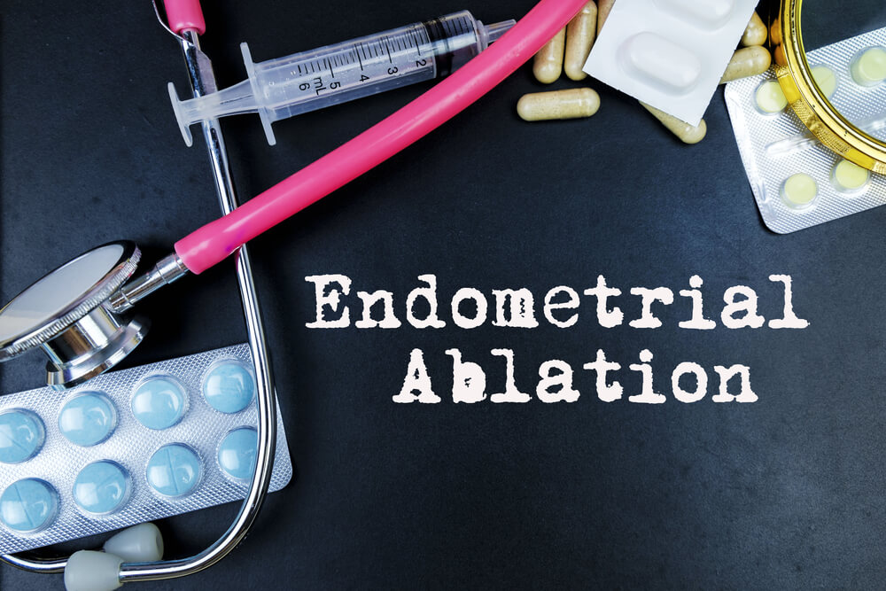 Endometrial Ablation Medical Term Word With Medical Concepts in Blackboard and Medical Equipment