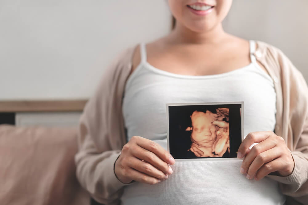 Asian Pregnant Woman Holding Ultrasound 4D Scan Image