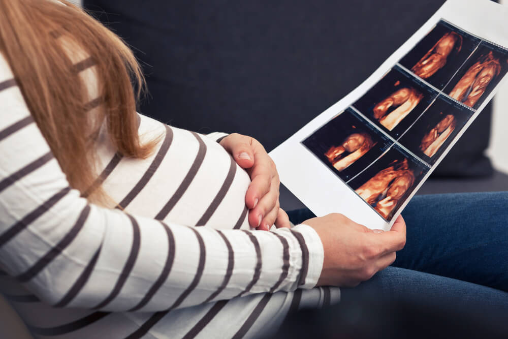 The Pregnant Woman Is Looking on the Photo of Her Child Making by Ultrasound