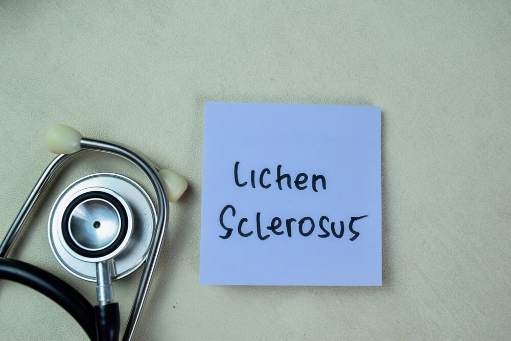 Concept Of Lichen Sclerosus Write On Sticky Notes With Stethoscope Isolated On Wooden Table.