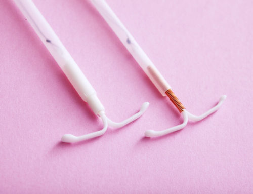IUD Removal: What to Expect