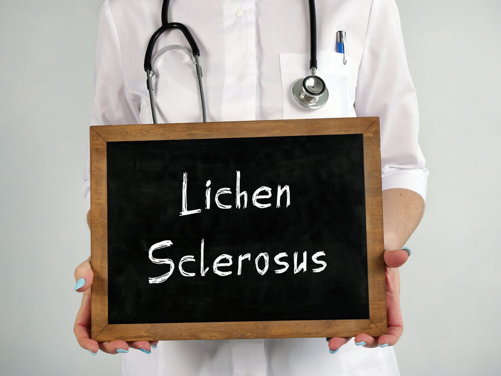 Medical Concept About Lichen Sclerosus With Inscription on the Sheet.