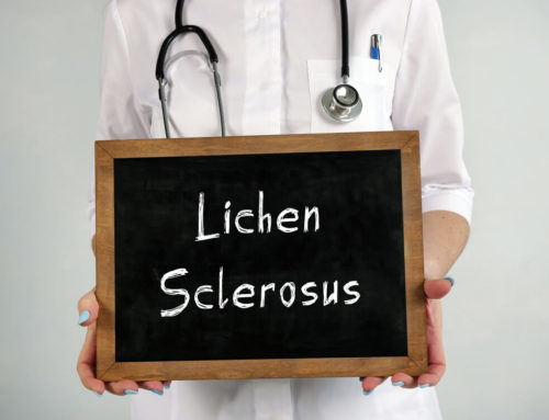 Can I Cure Vulvar Lichen Sclerosus Naturally