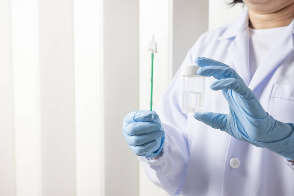 Doctor Hand Holding Liquid Base Cytology Set on Blue Background