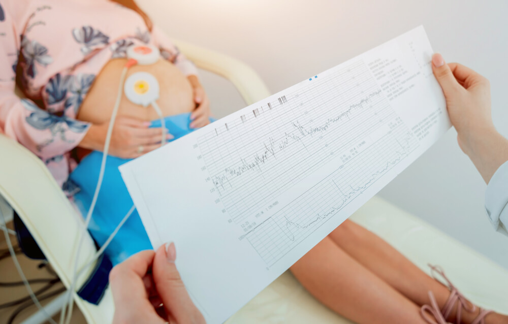 Pregnant Woman With Electrocardiograph Check Up for Her Baby.