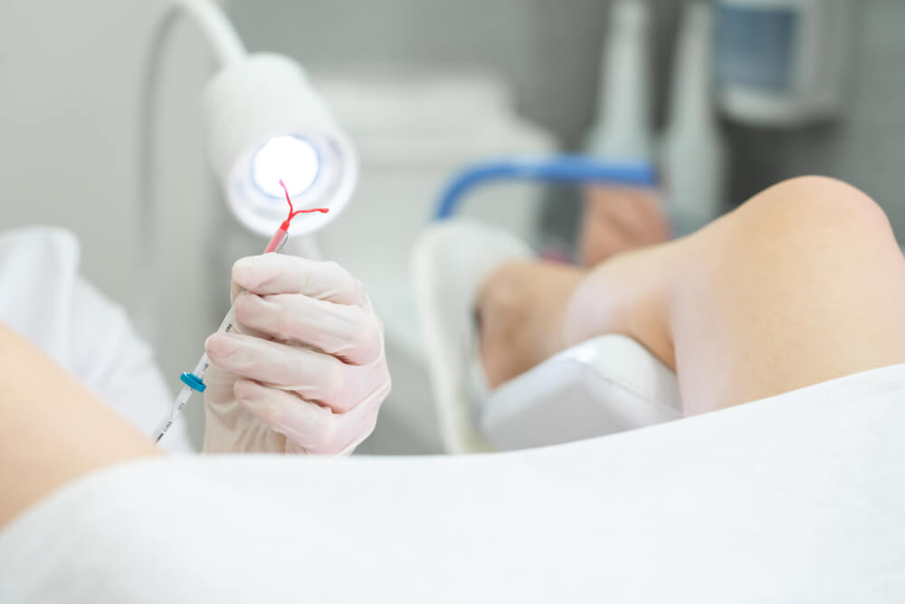 Gynecologist Holding an Iud Birth Control Device Before Using It for Patient