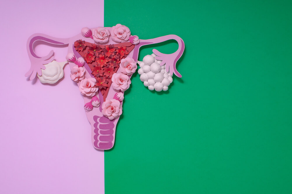 Concept Polycystic Ovary Syndrome, Pcos.