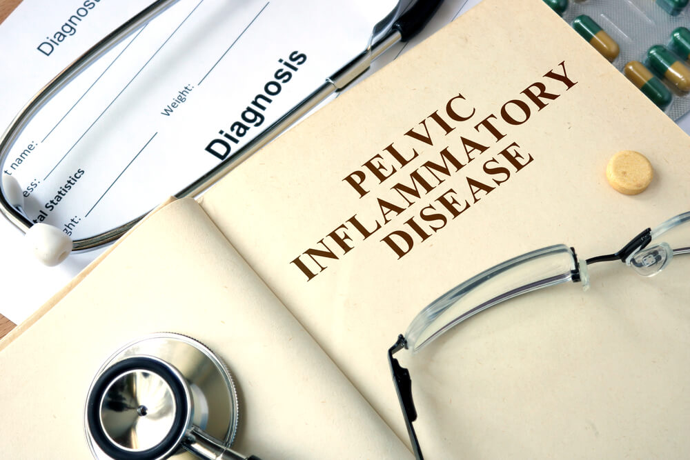 Word Pelvic inflammatory disease (PID