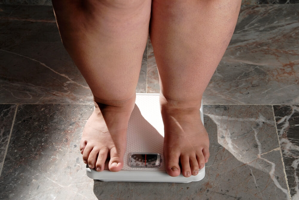 Obesity and Overweight Overweight Woman Feet on the Scale Concept of Obesity and Bad Habits