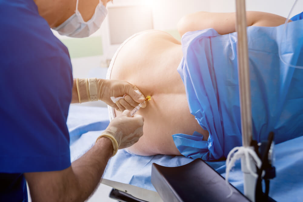 Epidural anesthesia injections