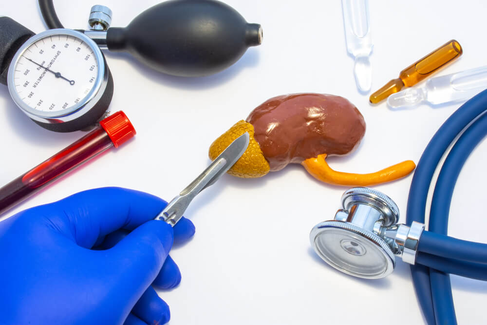 Concept Photo of Adrenal Surgery, Operation of Adrenalectomy or Removal
