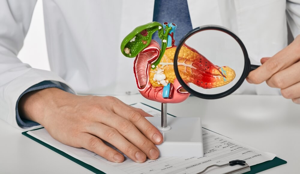 Doctor Consulting Patient With Acute Pancreatitis Patient Pointing Out Pancreatic Disease on Anatomical Model