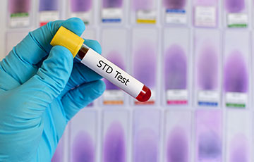 STD Testing Tube