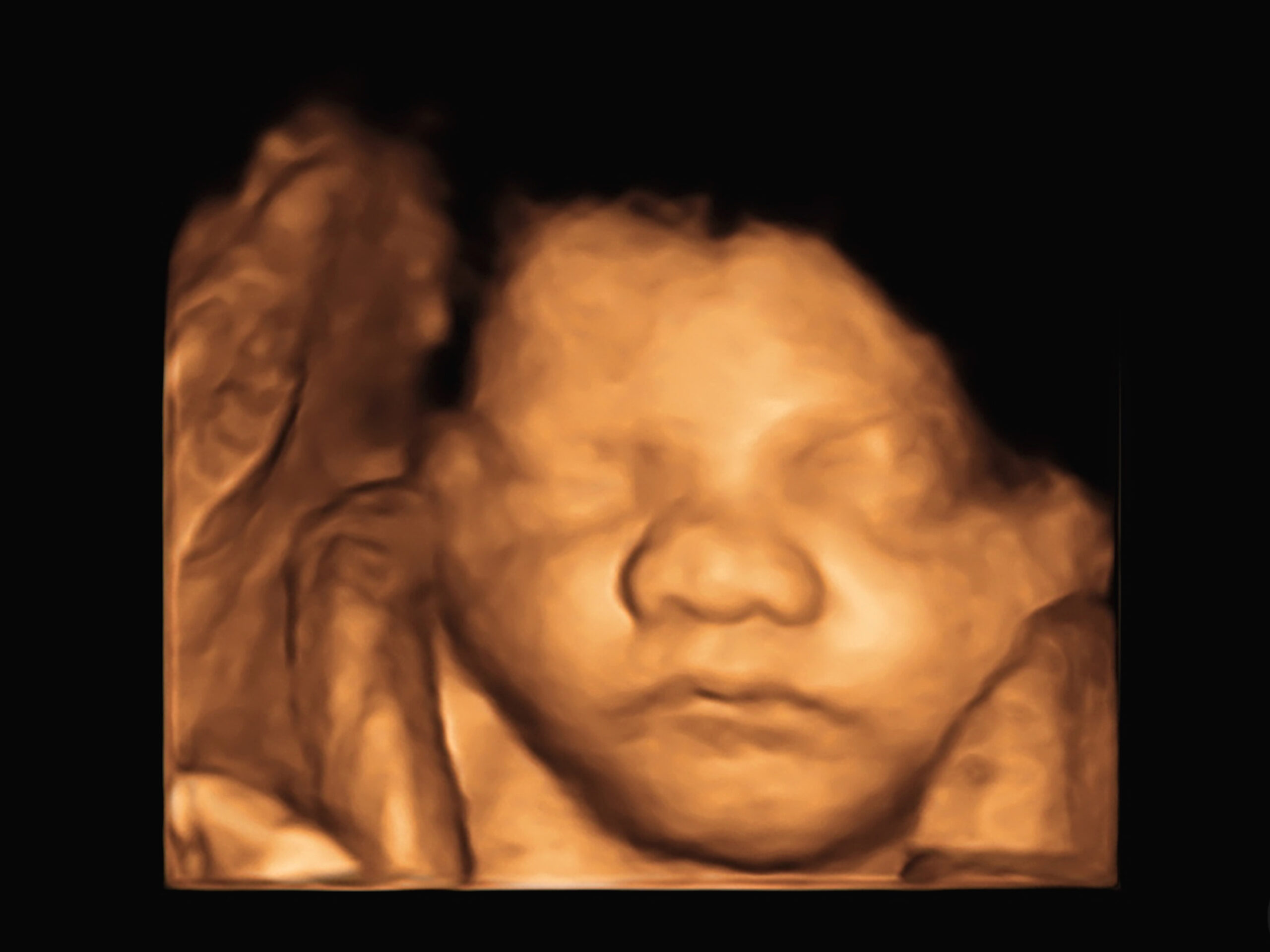 image Ultrasound 3D4D of baby in mother’s womb.