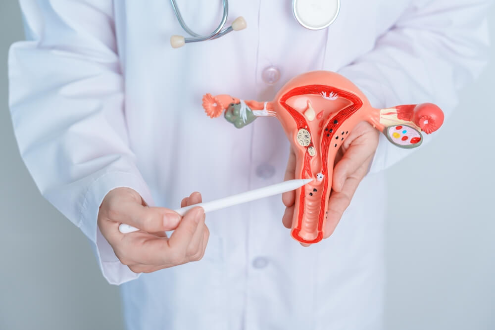 Doctor holding Uterus and Ovaries model. Ovarian and Cervical cancer, Cervix disorder, Endometriosis, Hysterectomy, Uterine fibroids, Reproductive system and Pregnancy concept