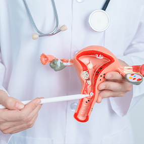 Fibroid Treatment 285×285