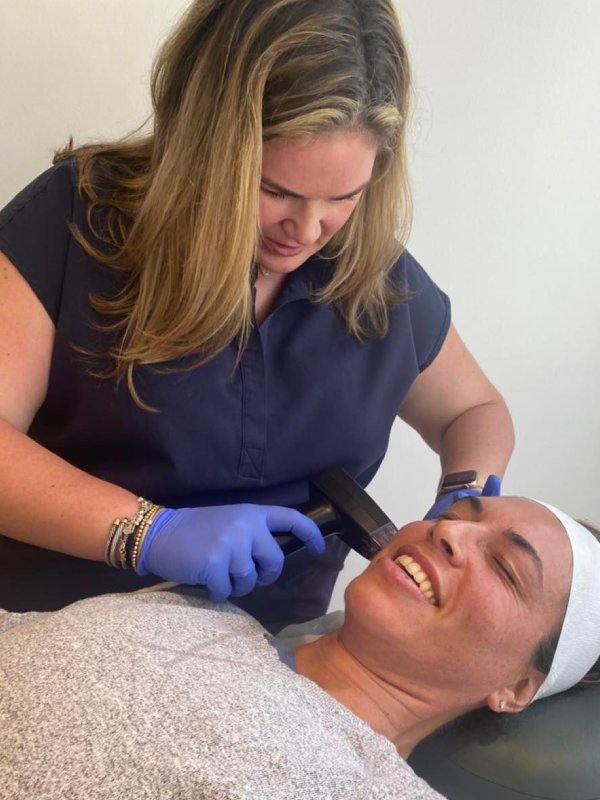 morpheus8-600×800 | South Miami OB-GYN Associates