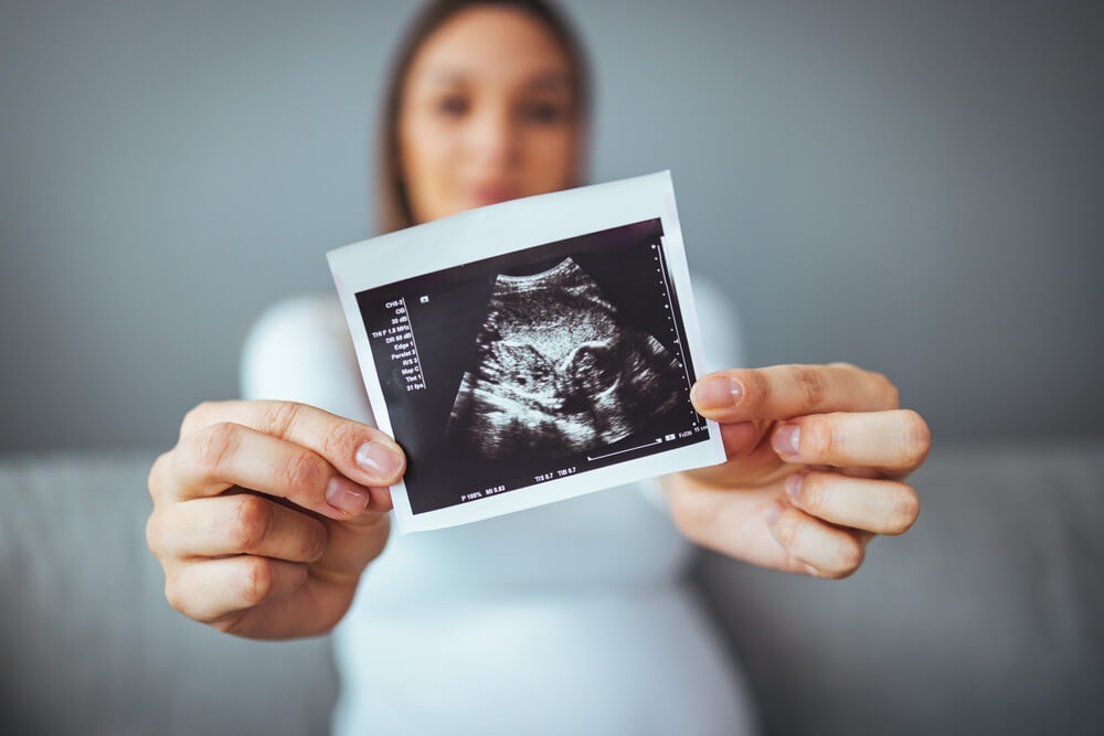 Happy Young Pregnant Woman Holding an Ultrasound Scan Image.