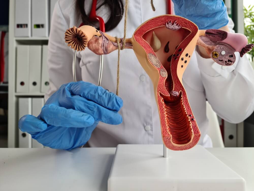 Gynecologist ligates fallopian tubes using model of the female reproductive system as example. Contraception for unwanted pregnancy