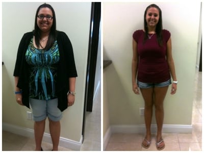 A woman who went to the weight loss surgery - before and after