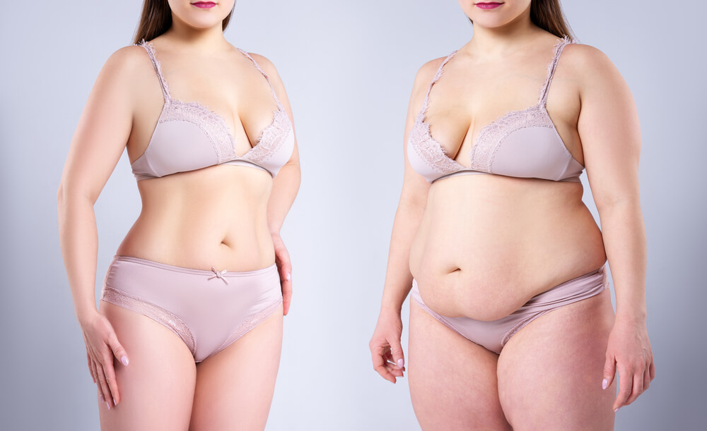 Woman’s Body Before and After Weight Loss on Gray Background