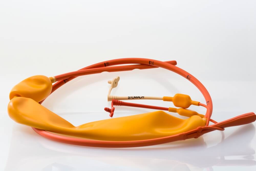 Sengstaken Tube Used To Control Emergency Upper Gastrointestinal Bleeding Due To Esophageal Varices In Case Of Cirrhosis