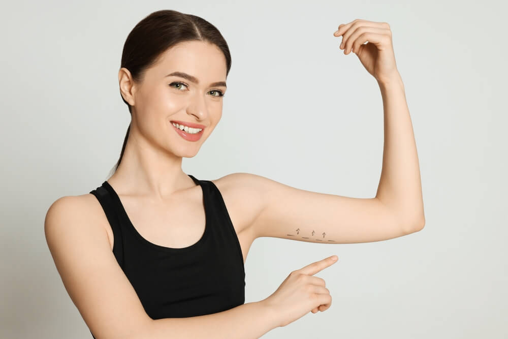 Slim Young Woman With Marks On Arm Against Light Background. Weight Loss Surgery