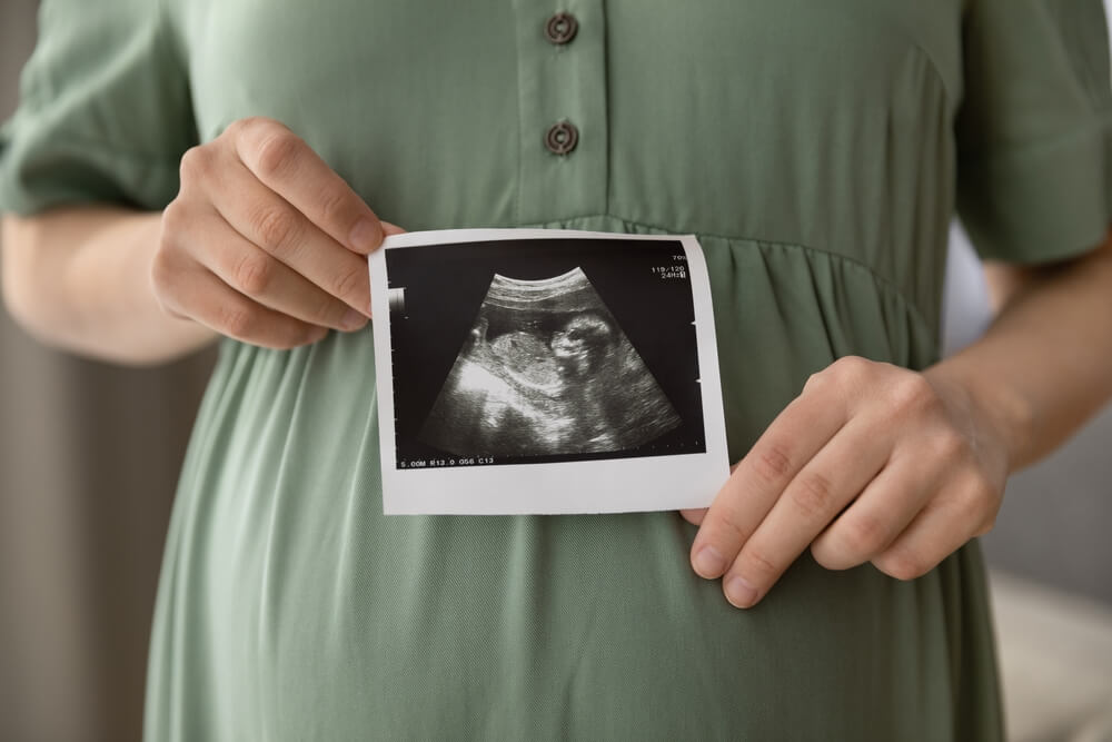 Prenatal Ultrasound Screening. Cropped Close Up Shot of Young Pregnant Female Holding Sonogram Picture of Unborn Baby Inside Her Big Belly