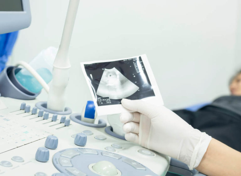 Placenta Previa Symptoms, Causes, and Treatment Trogolo Obstetrics and Gynecology